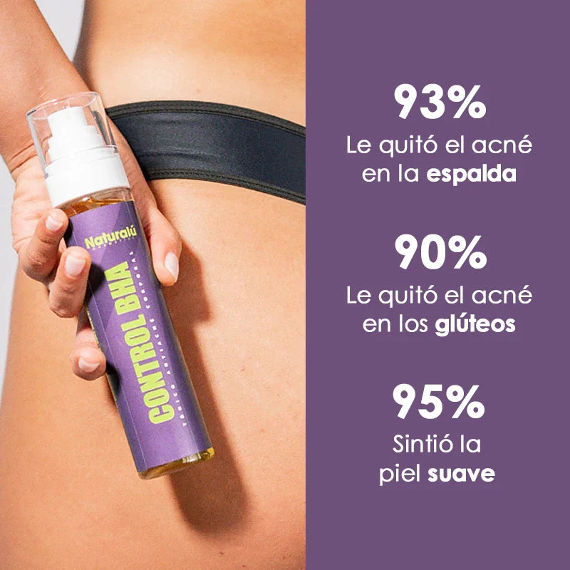Naturalú Spray™ para eliminar acné corporal y manchas en la piel