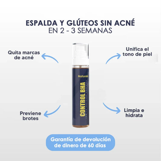 Naturalú Spray™ para eliminar acné corporal y manchas en la piel