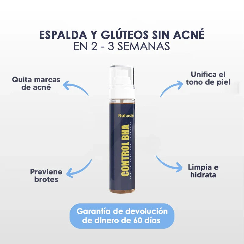 Naturalú Spray™ para eliminar acné corporal y manchas en la piel