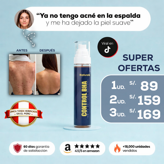 Naturalú Spray™ para eliminar acné corporal y manchas en la piel